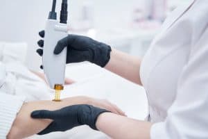 Doctor in gloves removing hair from woman arm with alexandrite laser