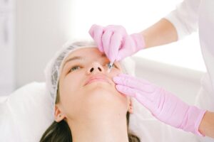 Getting Dermal Fillers