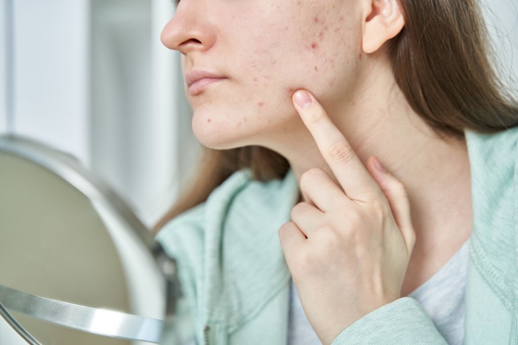 problems with skin