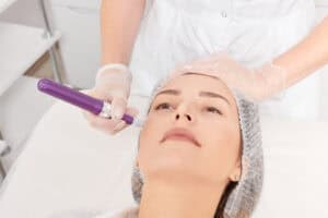 Microneedling Supports the Healing Process
