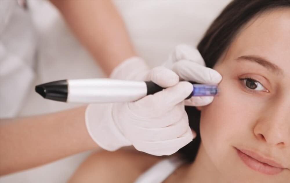 SkinPen Aftercare Lisa Rux Medical Aesthetician