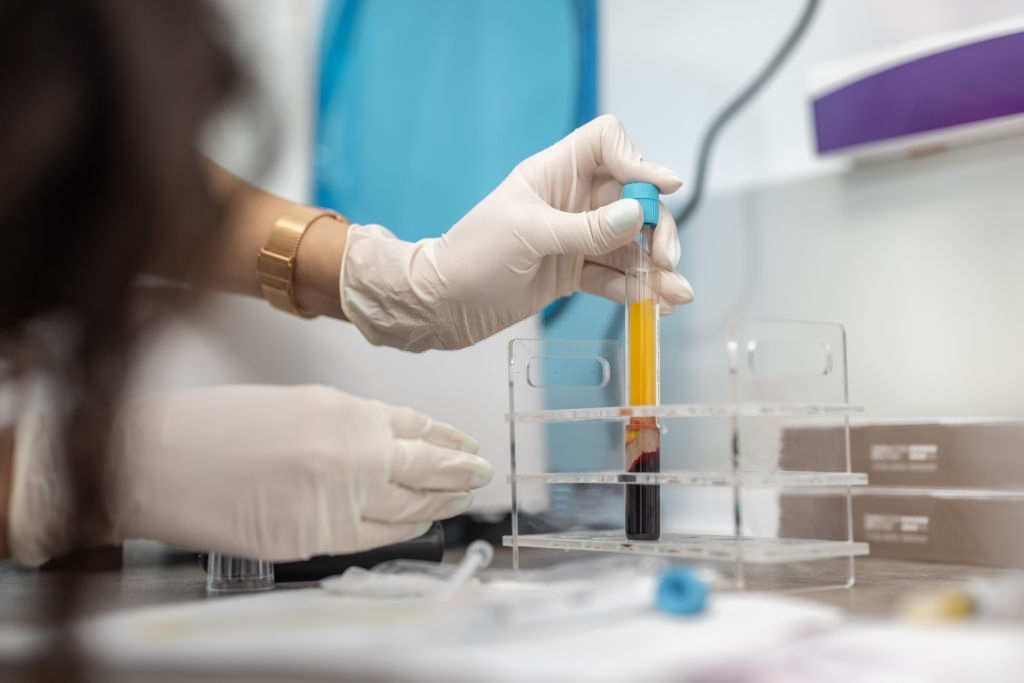 Platelet Rich Plasma in the Lab