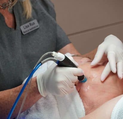 A customer receiving the microdermabrasion treatment