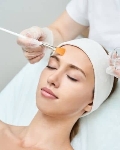 TCA Chemical Peel treatments makes you healthier and younger.